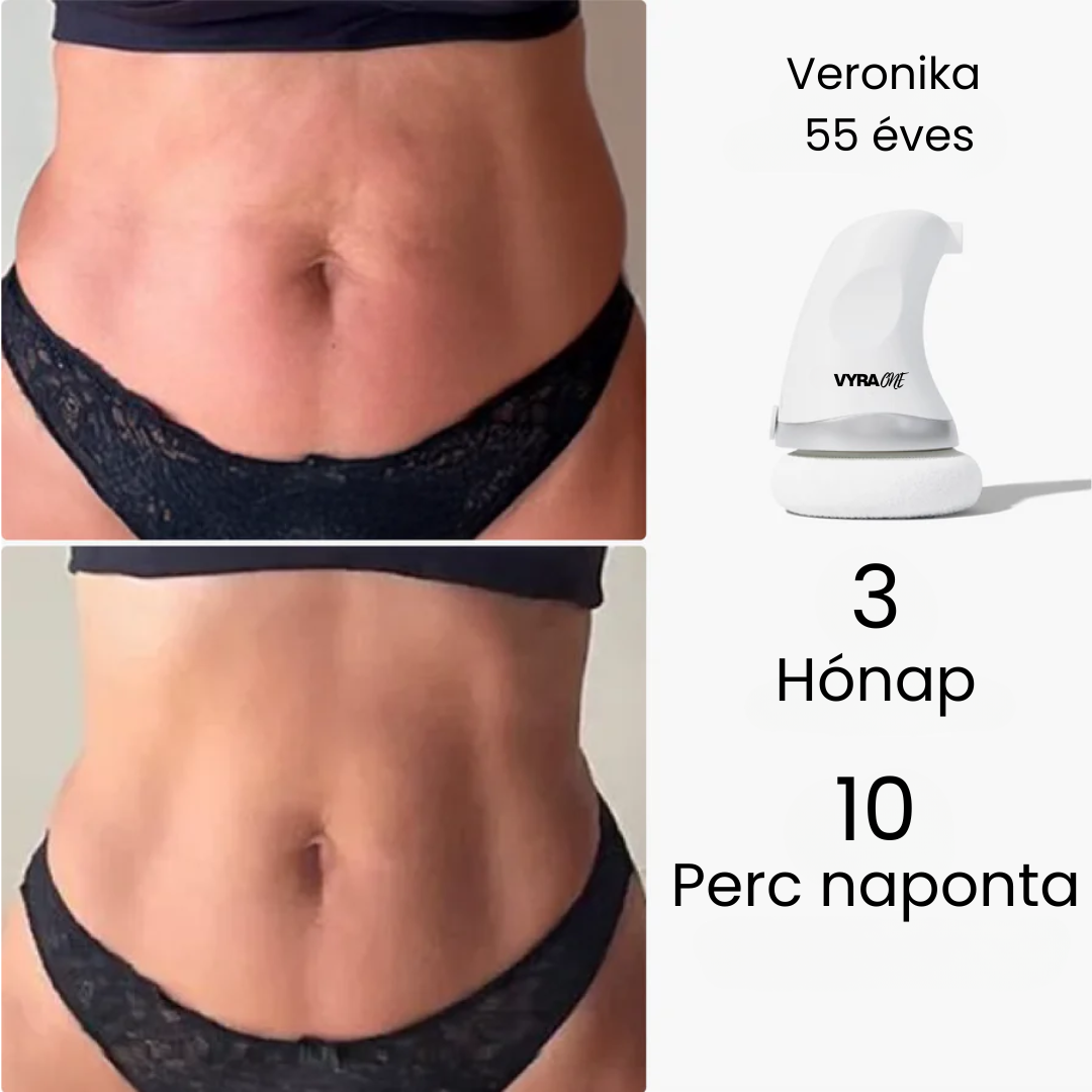VYRA ONE - Alakformáló